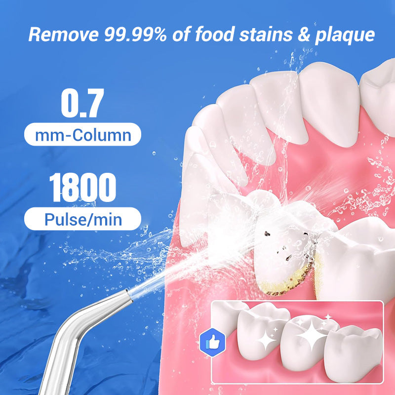 Portable Oral Irrigator – Water Flosser! 💧🦷