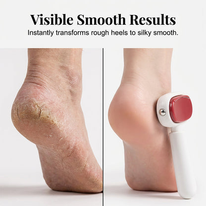 TYIIMAX™ Double-Sided Foot Scraper – Easily Removes Calluses and Dead Skin ✨🦶